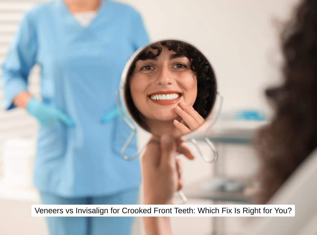 Veneers vs Invisalign for Crooked Front Teeth Which Fix Is Right for You